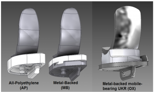 Fig.3: Three configurations of a unicompartmental knee replacement (UKR), where the material and constraints vary. A figure showing three different types of unicompartmental knee replacement implants. The first consists of an all polyethylene tibial component, the second a metal-backed tibial component and the thrid a metal-backed mobile bearing component.