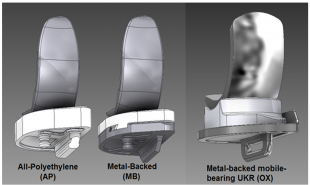 A figure showing three different types of unicompartmental knee replacement implants. The first consists of an all polyethylene tibial component, the second a metal-backed tibial component and the thrid a metal-backed mobile bearing component.