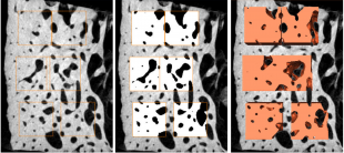 A three panel figure showing the same section of cortical bone under different stages of the reconstruction process, region of interest identification, segmentation, volume generation